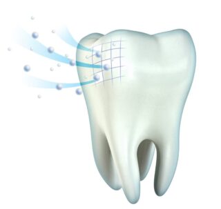 Fluoridation & Remineralisation