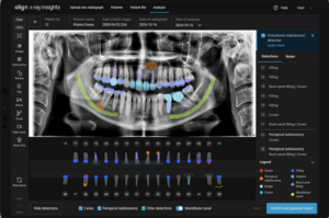 Screenshot einer zahnmedizinischen Analyse-Software, die ein Panoramaröntgenbild mit farbigen Markierungen für Befunde wie Füllungen, Kronen, Wurzelbehandlungen, Implantate und den Unterkieferkanal anzeigt
